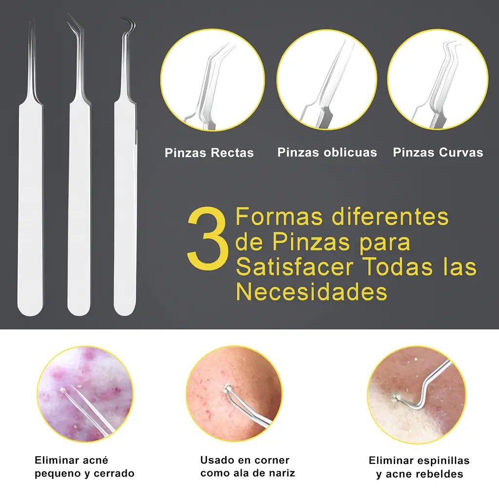 SkinFix™ – Elimina espinillas sin marcas con las herramientas más precisas PAGA 5 GRATIS 3