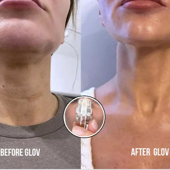 GLOV™ Skin Renewal: Cuidado facial con tecnología de microinfusión